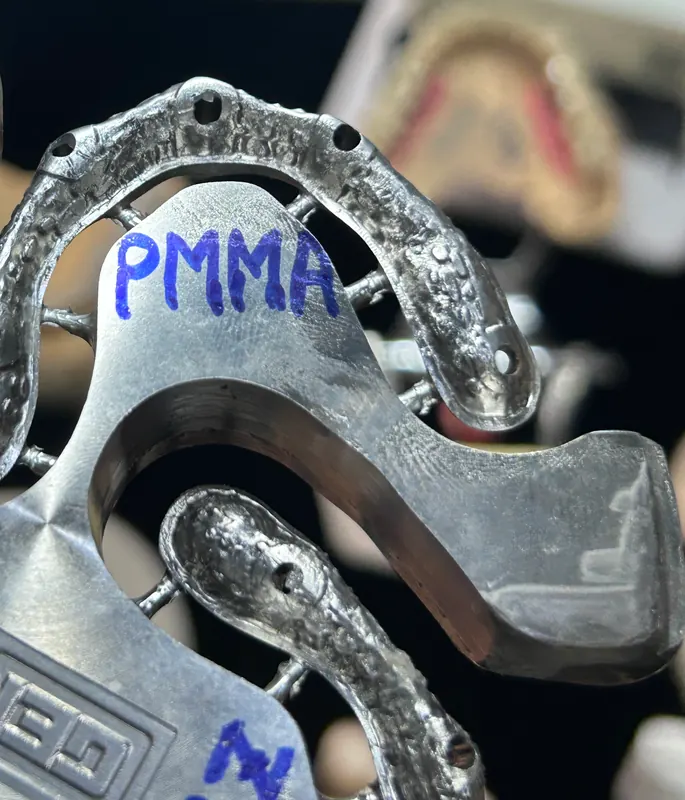 All-on-X 상부보철 (PMMA · 지르코니아) 사진 17