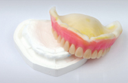 인코덴쳐 — Final Impression (Wax Denture 시적 후)
