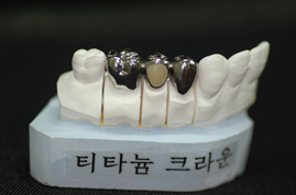 티타늄 프레임 — 2. Crown bridge등 Fixed 보철이 가능합니다.