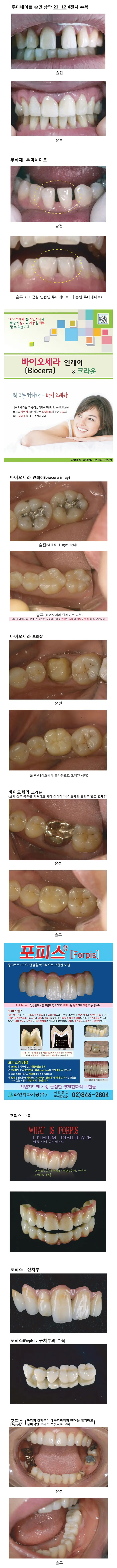 이멕스 바이오세라 임상 자료 이미지 4