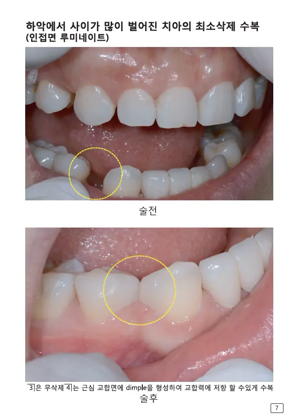 루미네이트 임상사례집 수록 이미지 7